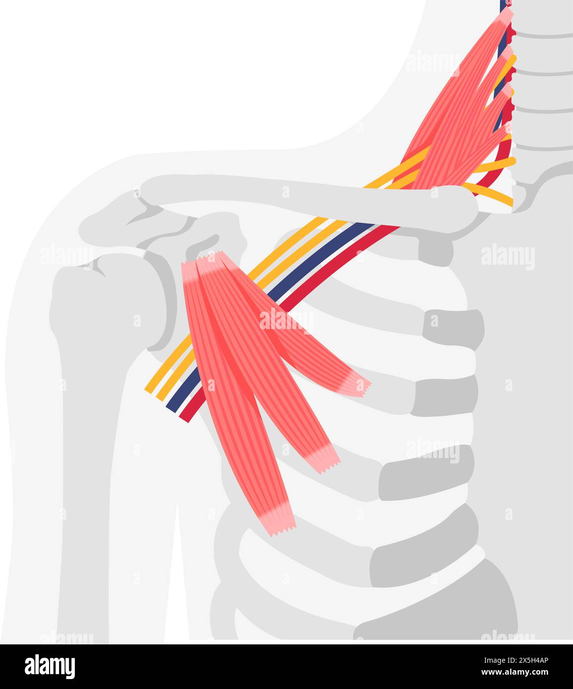 Vector illustration of where thoracic outlet syndrome occurs Stock Vector