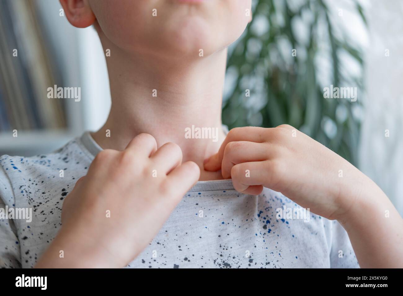close-up neck, caucasian child patient holding affected area, experiencing throat pain, loss of voice, various causes, medical attention and treatment Stock Photo
