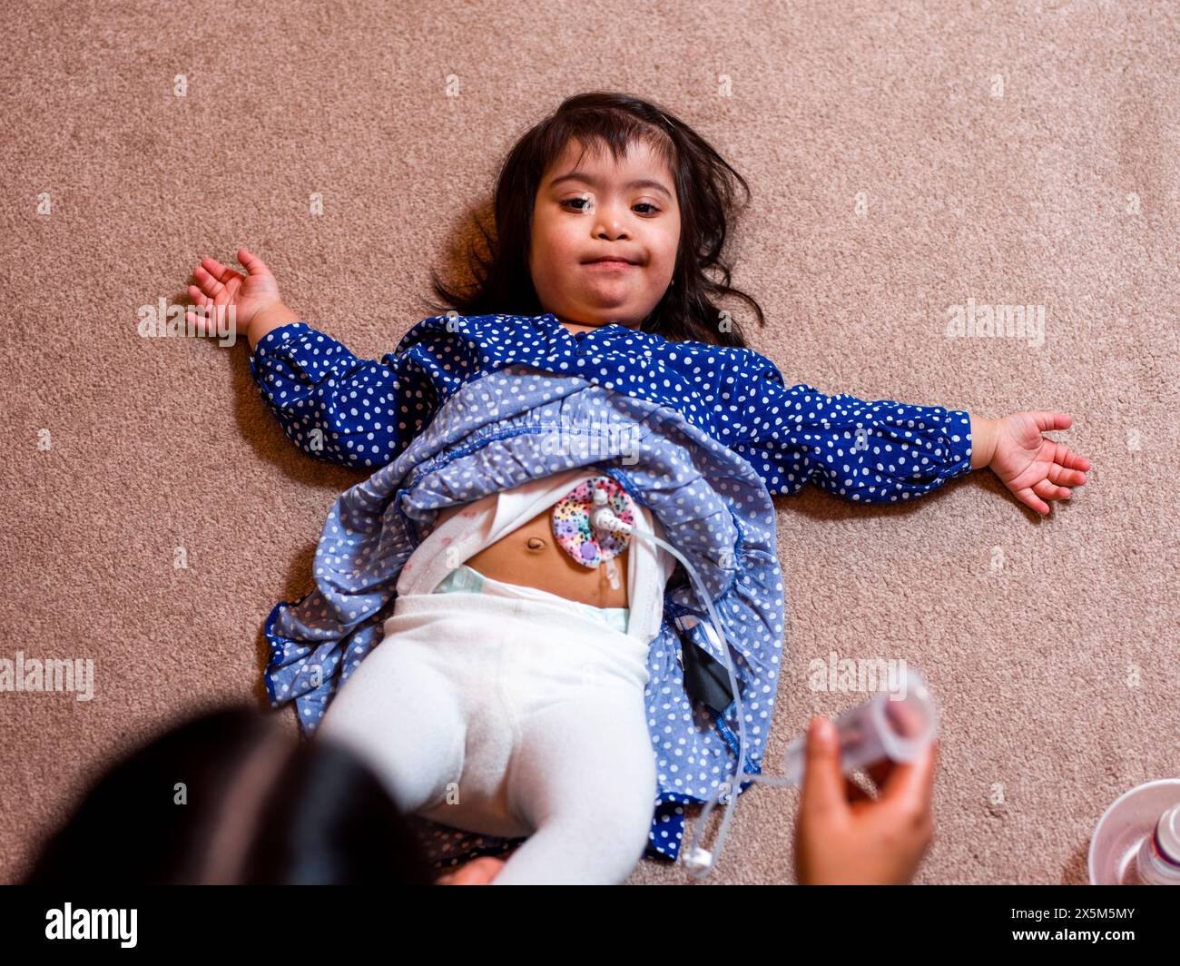 Mother feeding daughter through feeding tube Stock Photo