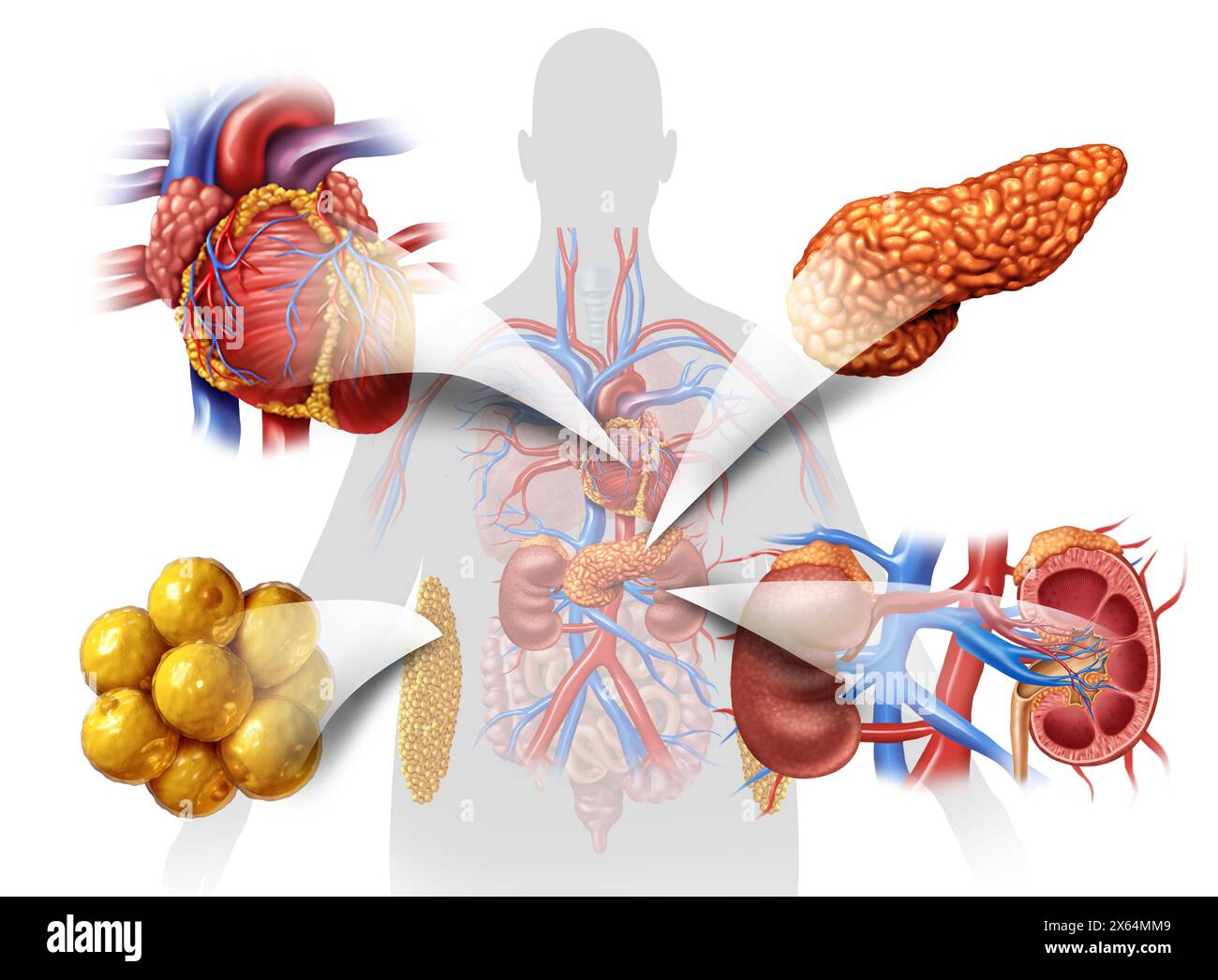Cardiovascular kidney metabolic syndrome as a multisystem disorder as disease related to a group of organs as kidneys heart pancreas and Adipose cells Stock Photo