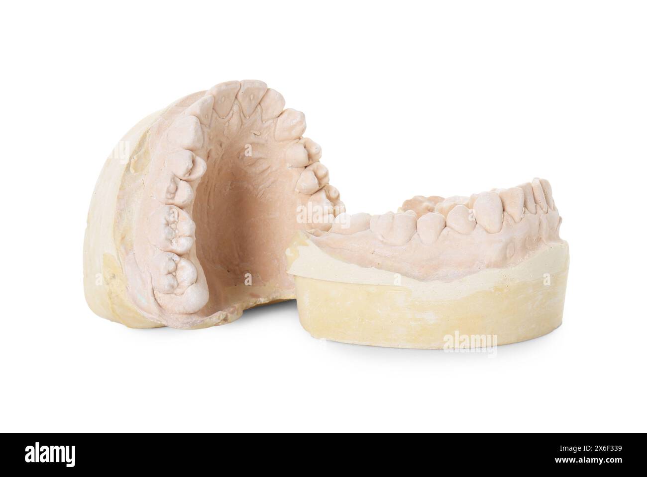 Dental model with jaws isolated on white. Cast of teeth Stock Photo - Alamy