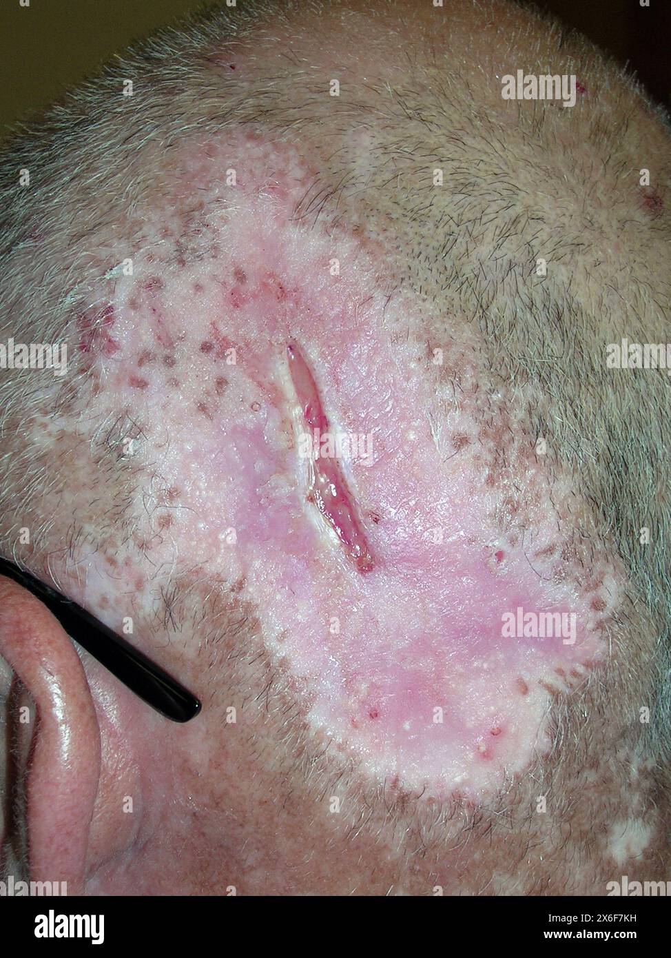 gabapentin treat itching