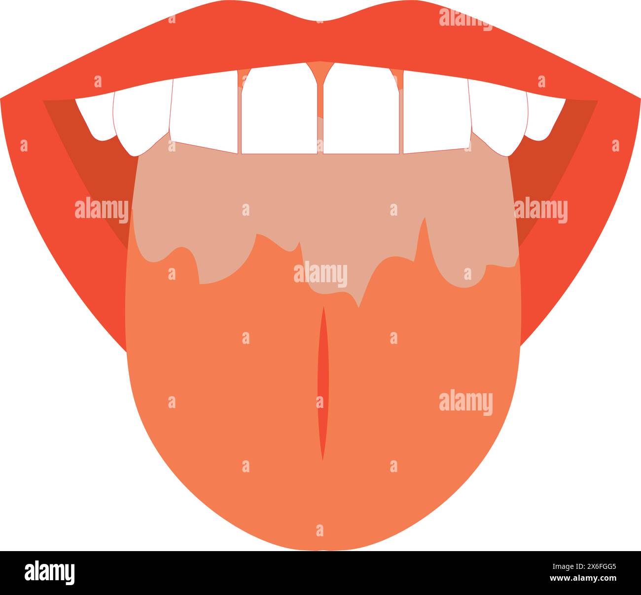 Illustration of tongue symptoms and health Stock Vector Image & Art - Alamy