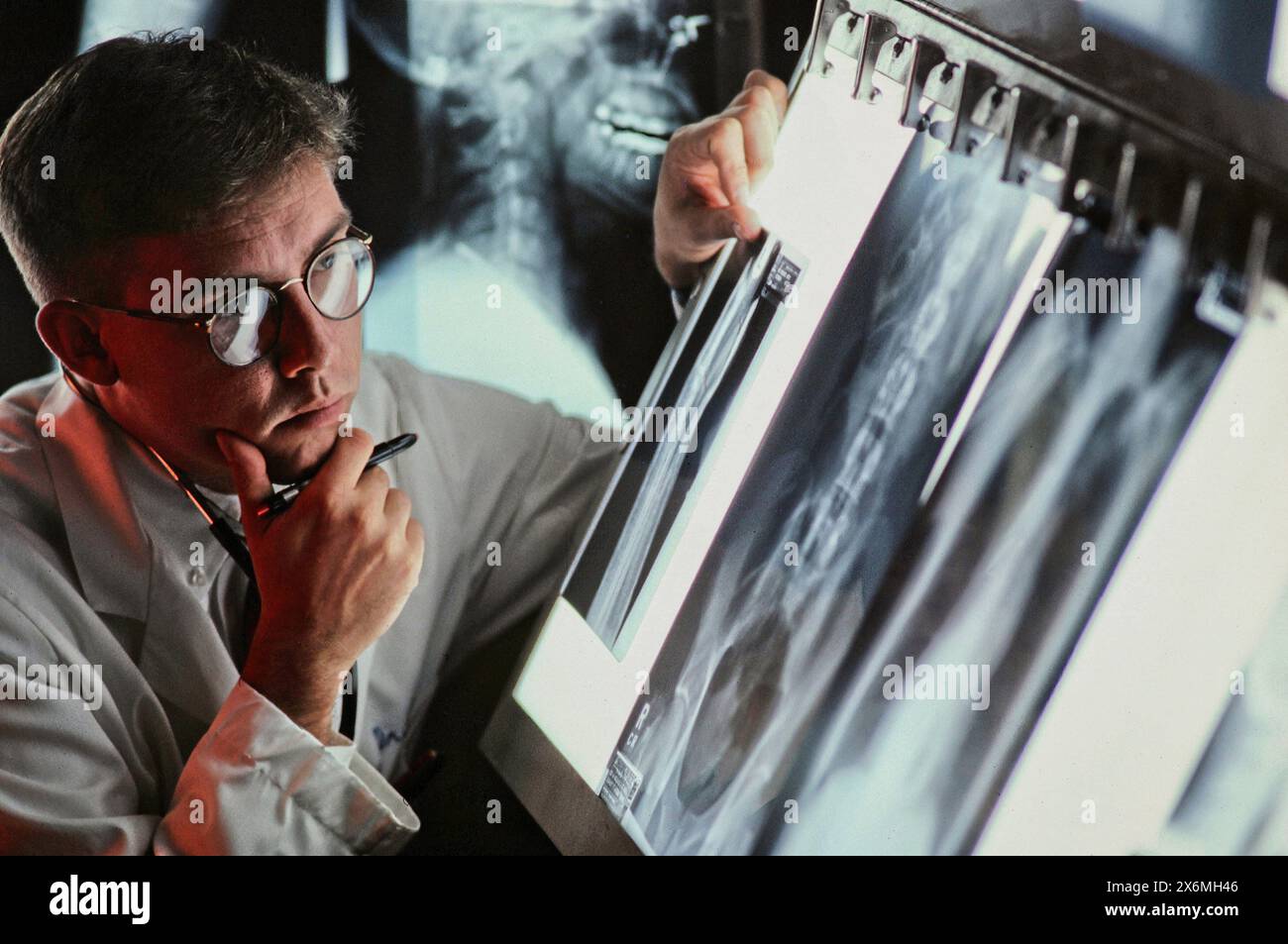 A doctor in a medical facility closely examines digital x-ray images displayed on a large monitor to diagnose and assess the condition of a patient. T Stock Photo