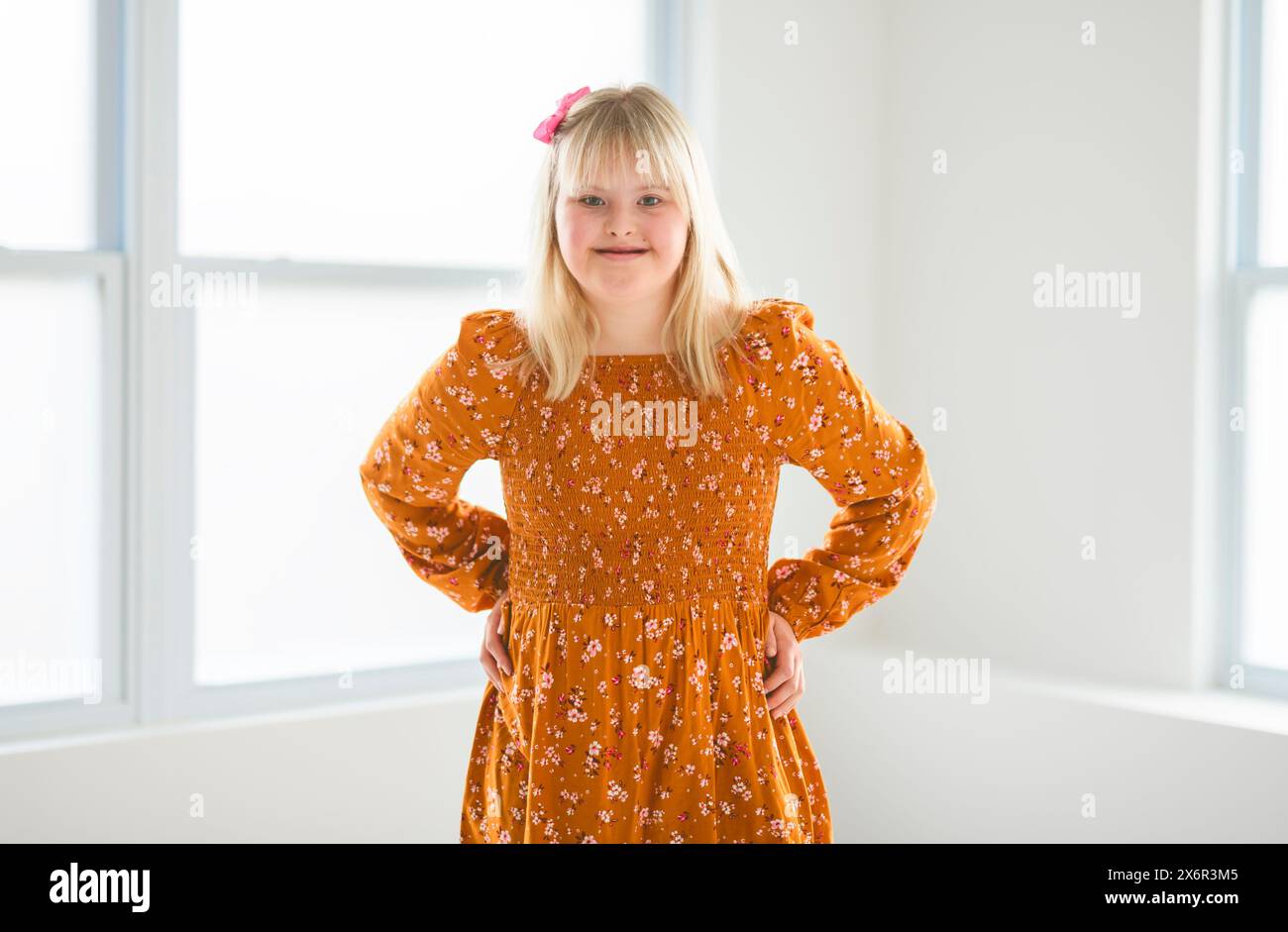 Portrait of beautiful little girl having down syndrome Stock Photo
