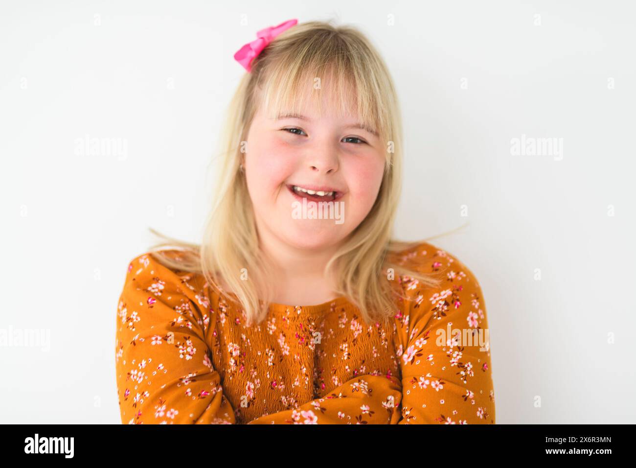 Portrait of beautiful little girl having down syndrome Stock Photo
