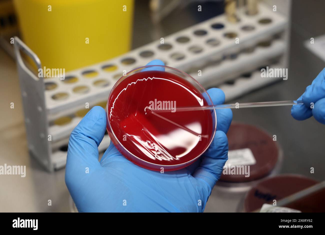 Microbial Rostock 16 May 2024, Mecklenburg-Western Pomerania, Rostock: In the ...