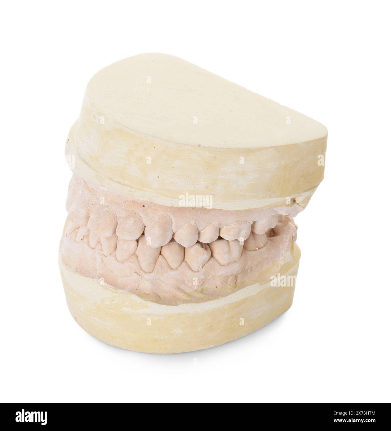 Dental model with jaws isolated on white. Cast of teeth Stock Photo - Alamy