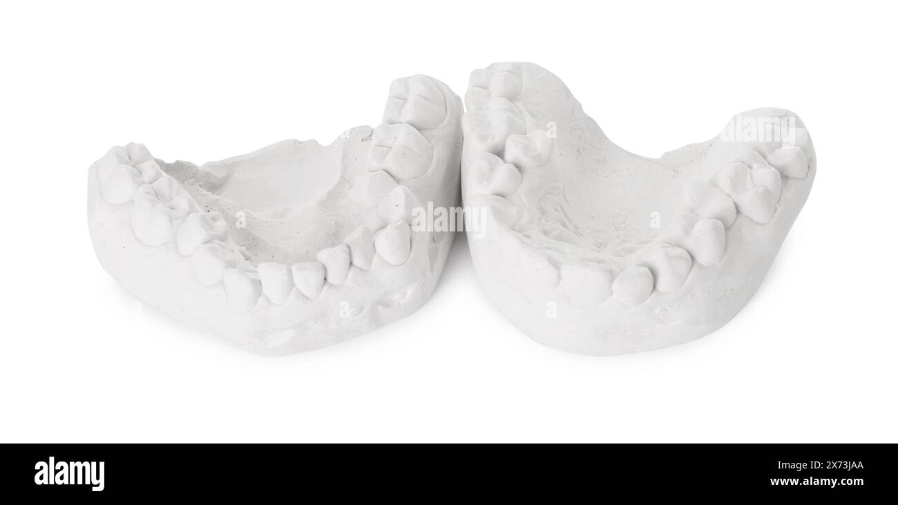 Dental model with gums isolated on white. Cast of teeth Stock Photo