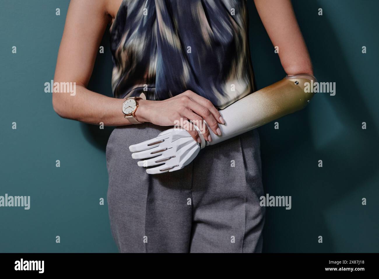 Woman one arm amputee hi-res stock photography and images - Alamy