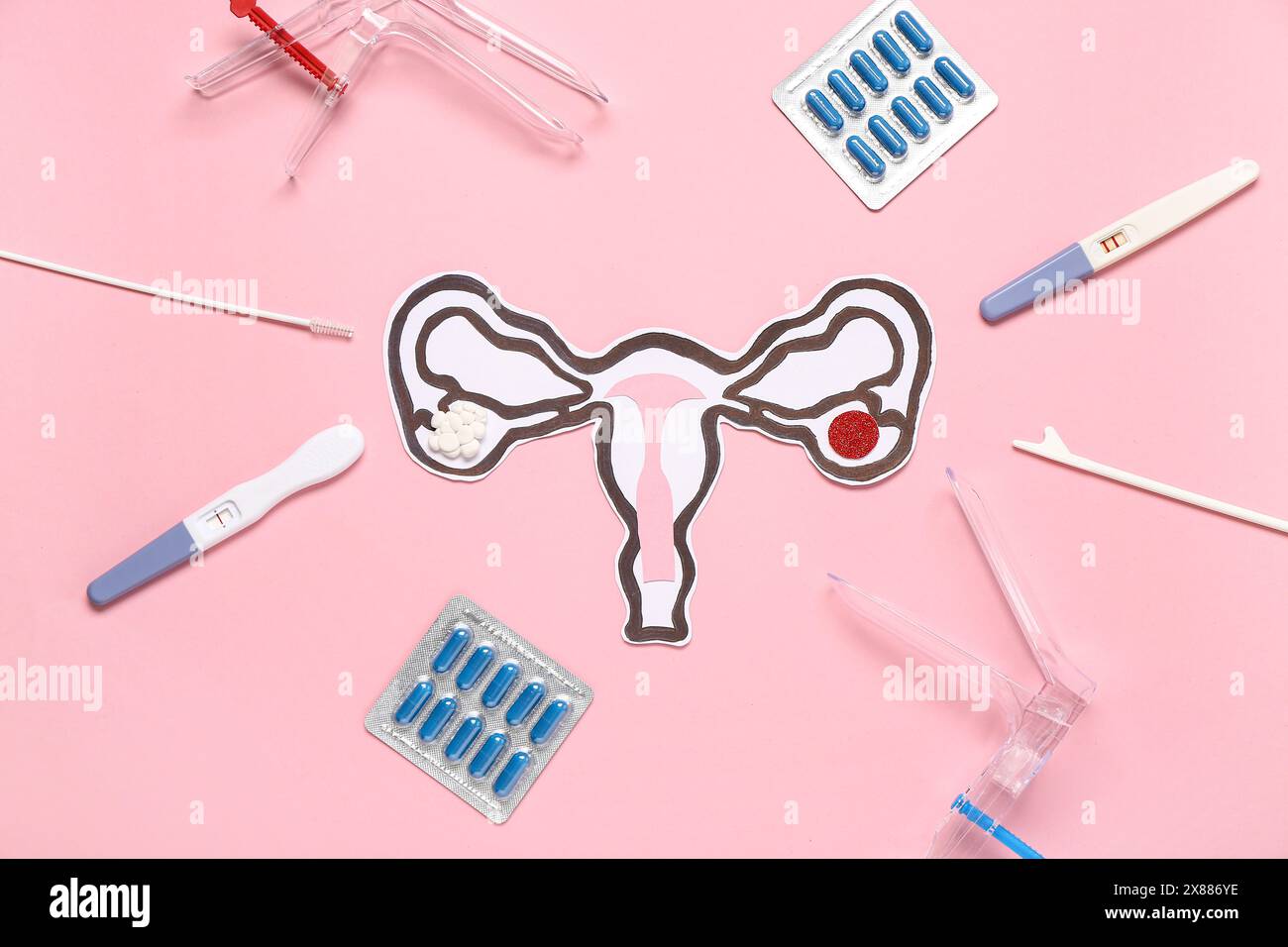 Paper uterus with gynecological speculums, pills and pap smear test
