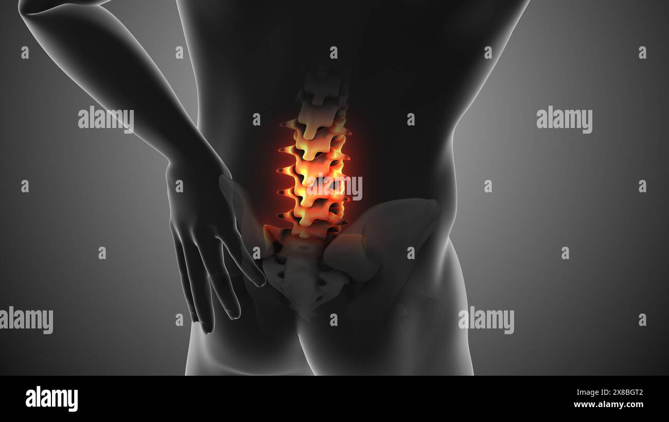 Pain In Body Human body pain anatomy hi-res stock photography and images - Alamy