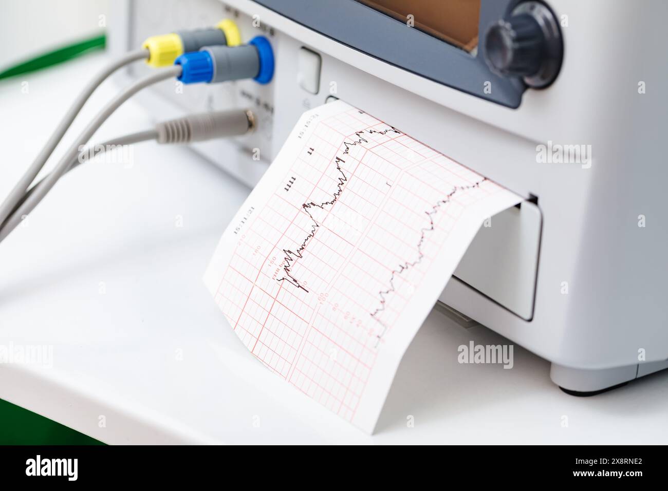 Uterine activity hi-res stock photography and images - Alamy