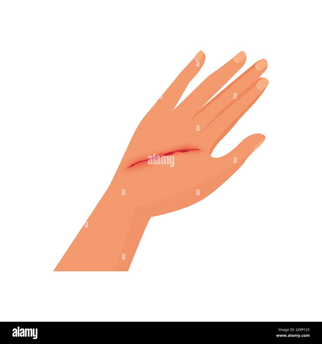 Injured human arm with trauma, open wound and blood on skin vector illustration Stock Vector