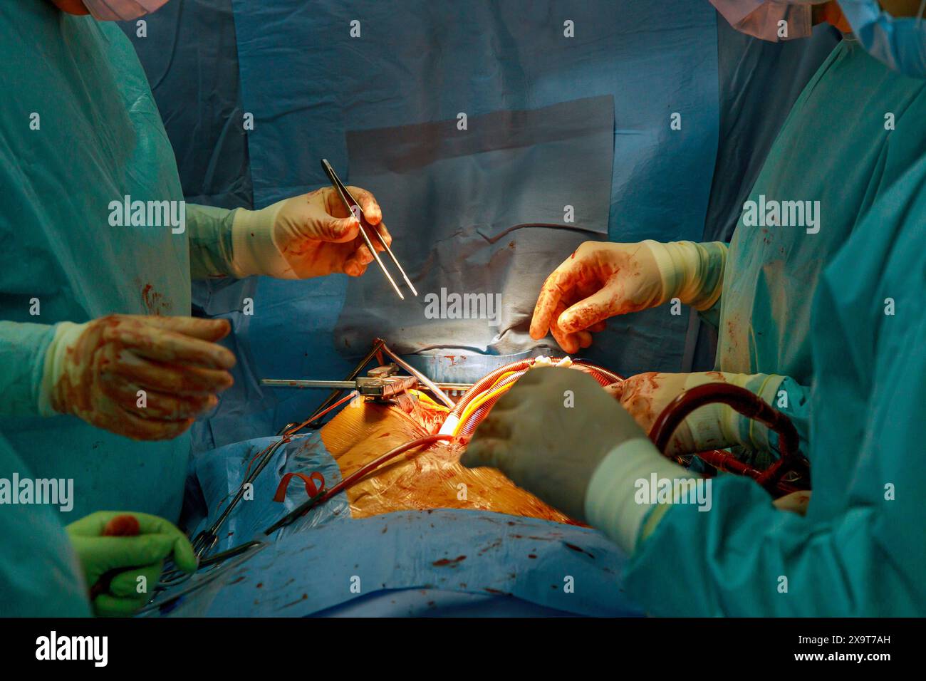 An operating room is used for performance heart surgery by team of ...