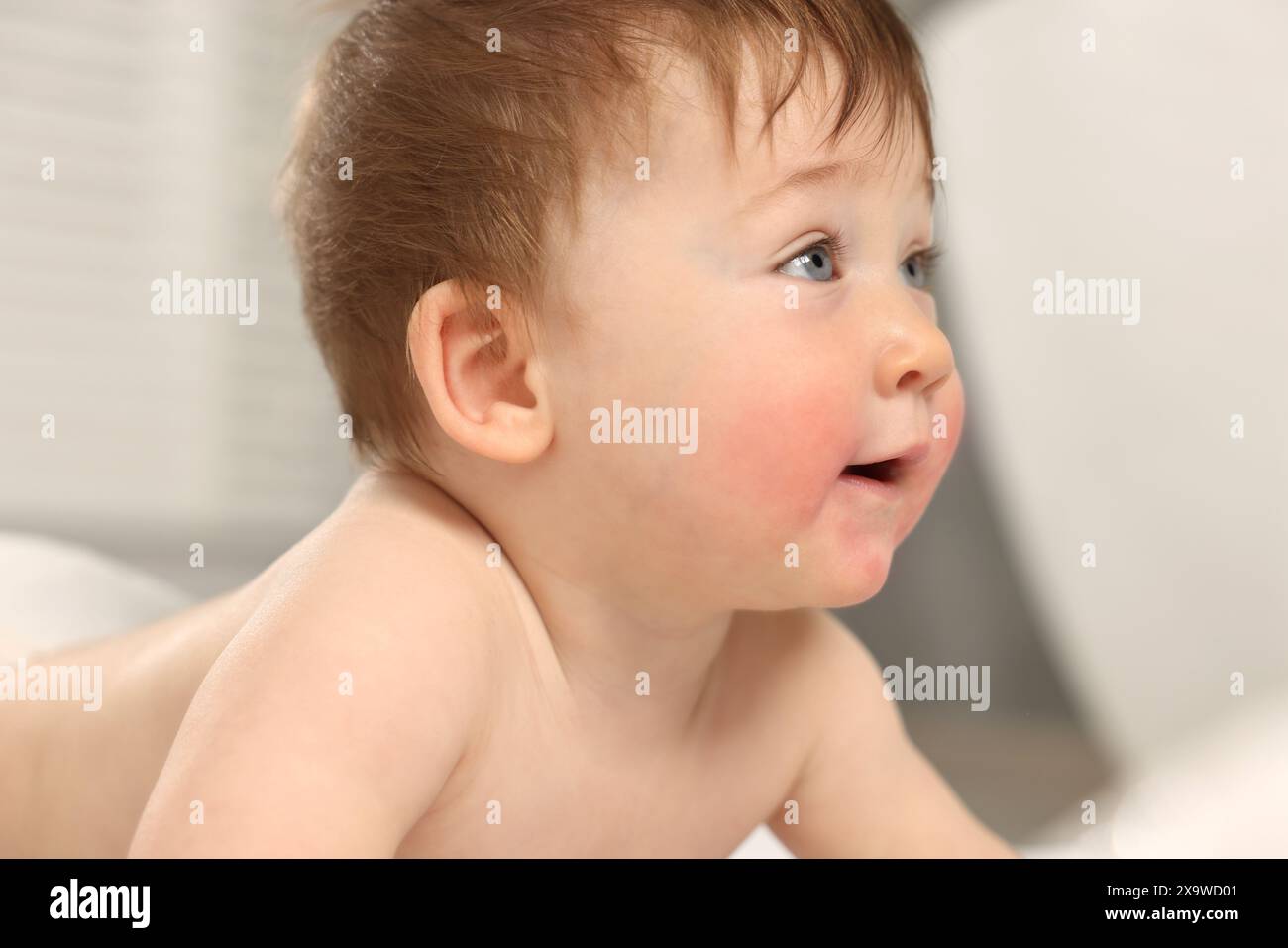 Cute little baby with allergic redness on cheeks indoors, closeup Stock