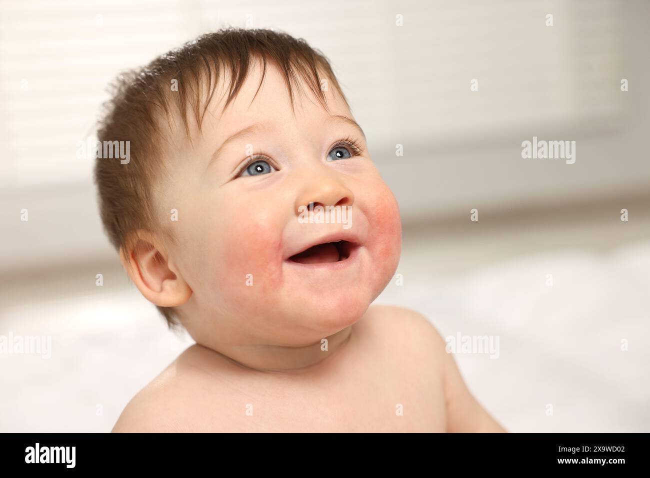 Cute little baby with allergic redness on cheeks indoors Stock Photo