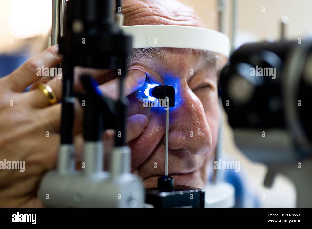 Cecil Farley has his artificial cornea examined as Frimley Health ...
