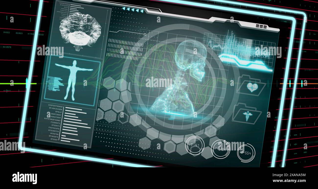 Image of medical data processing over financial data processing on black background Stock Photo