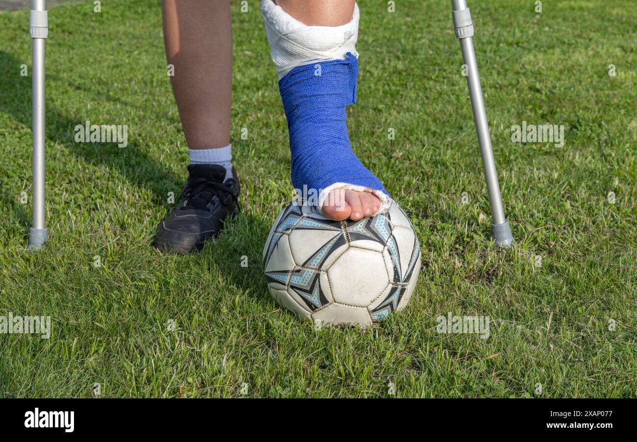 Boy with a broken leg in a cast during a football match an injury to a ...