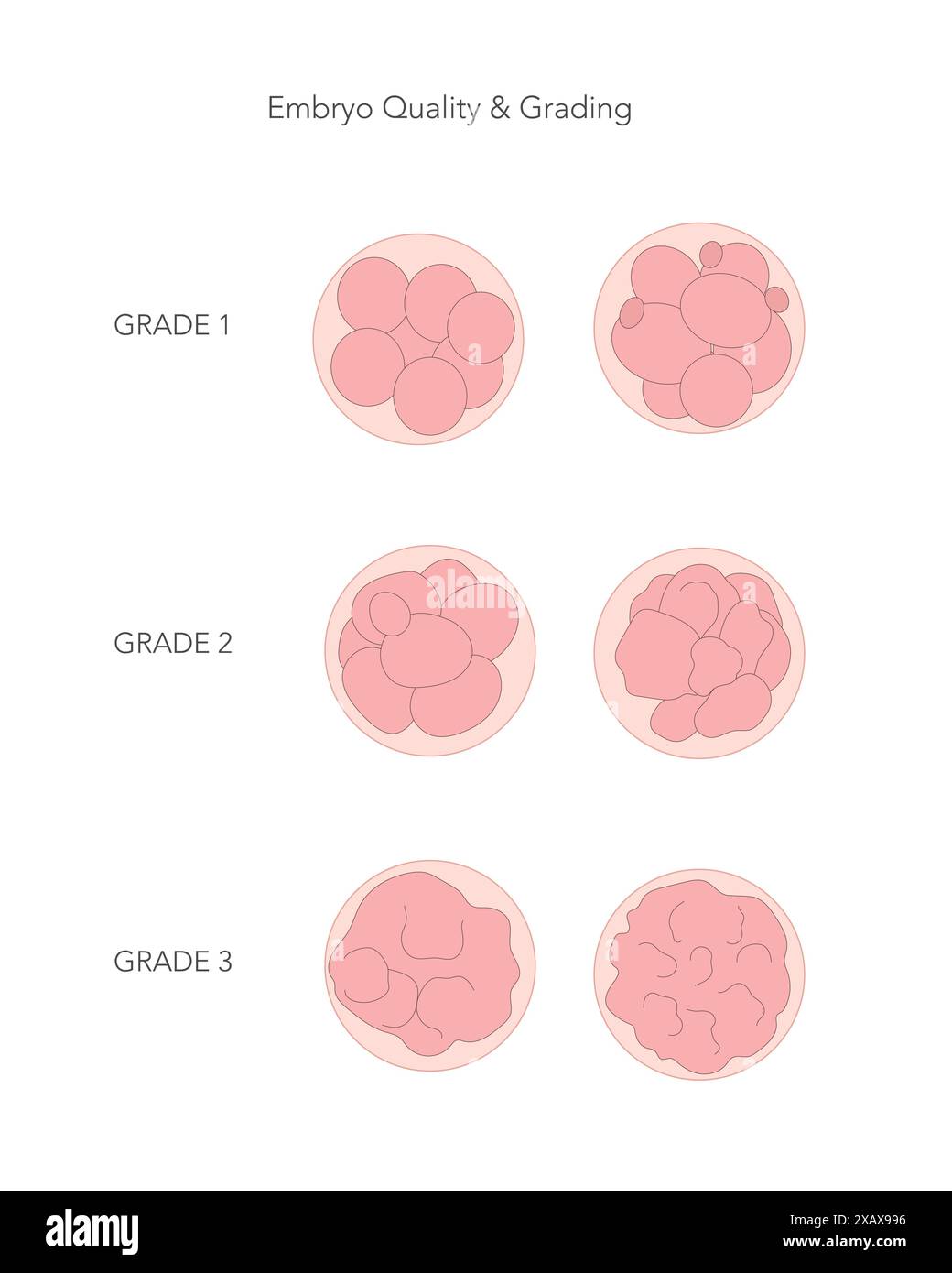 Embryos quality and grades. In vitro obtained human embryo early development Stock Vector Image