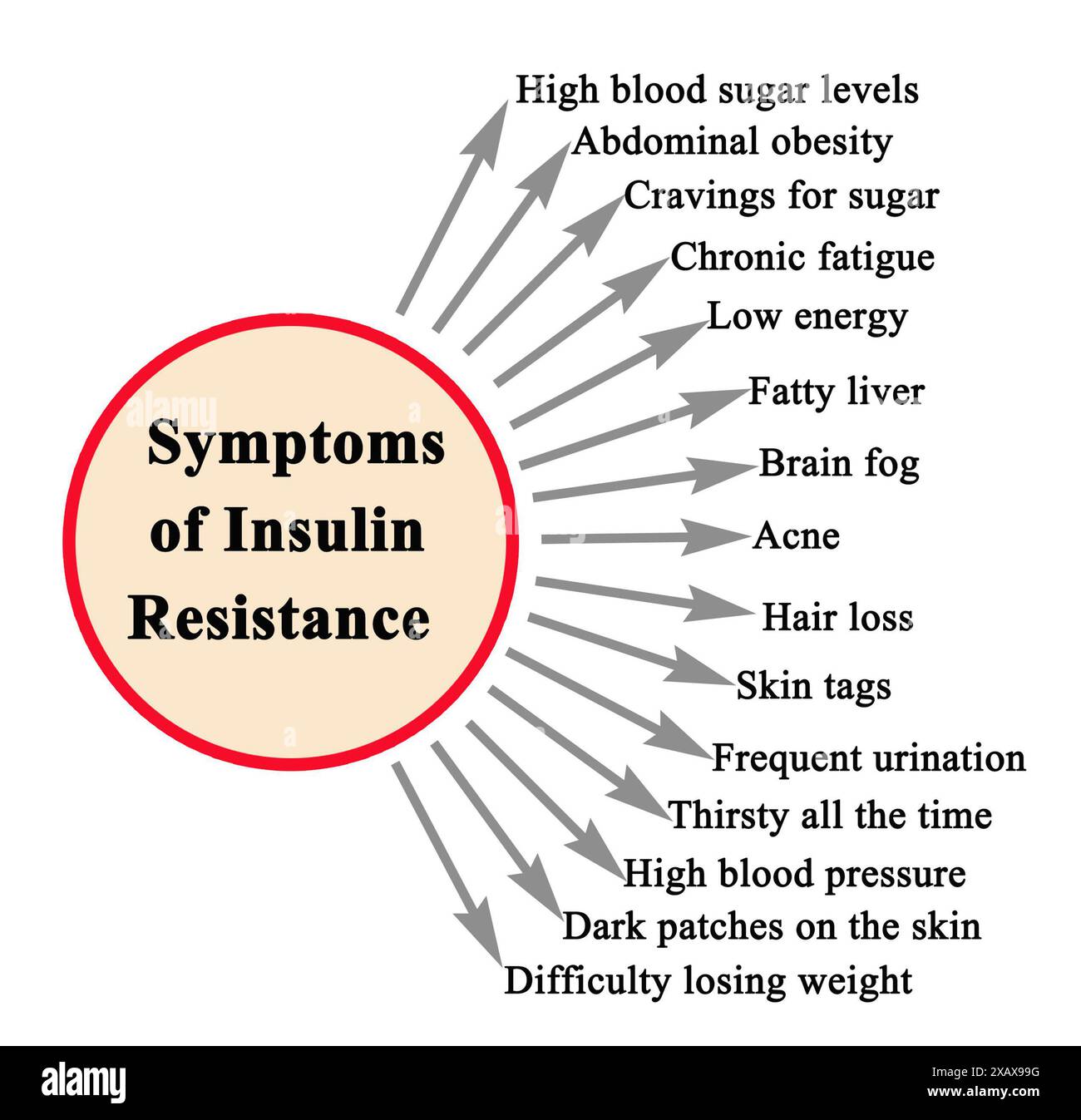 fifteen-symptoms-of-insulin-resistance-stock-photo-alamy