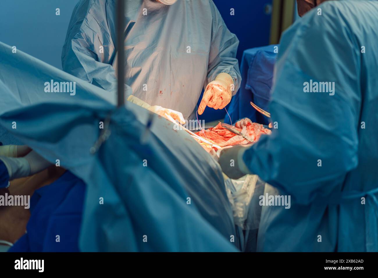 Two doctors performing an operation in the operating room. The surgeons ...