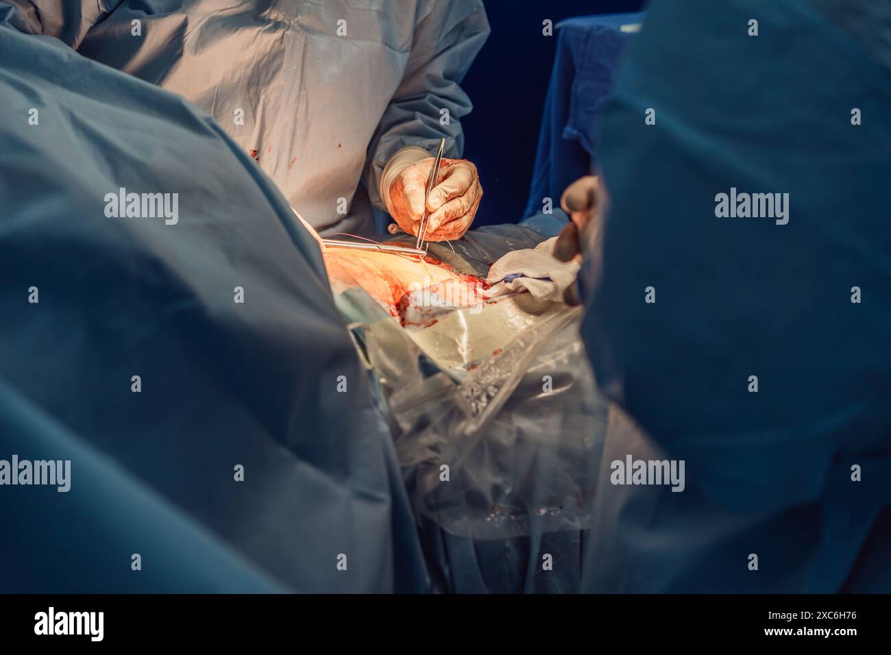 Hospital patient surrounded medical professionals hi-res stock ...