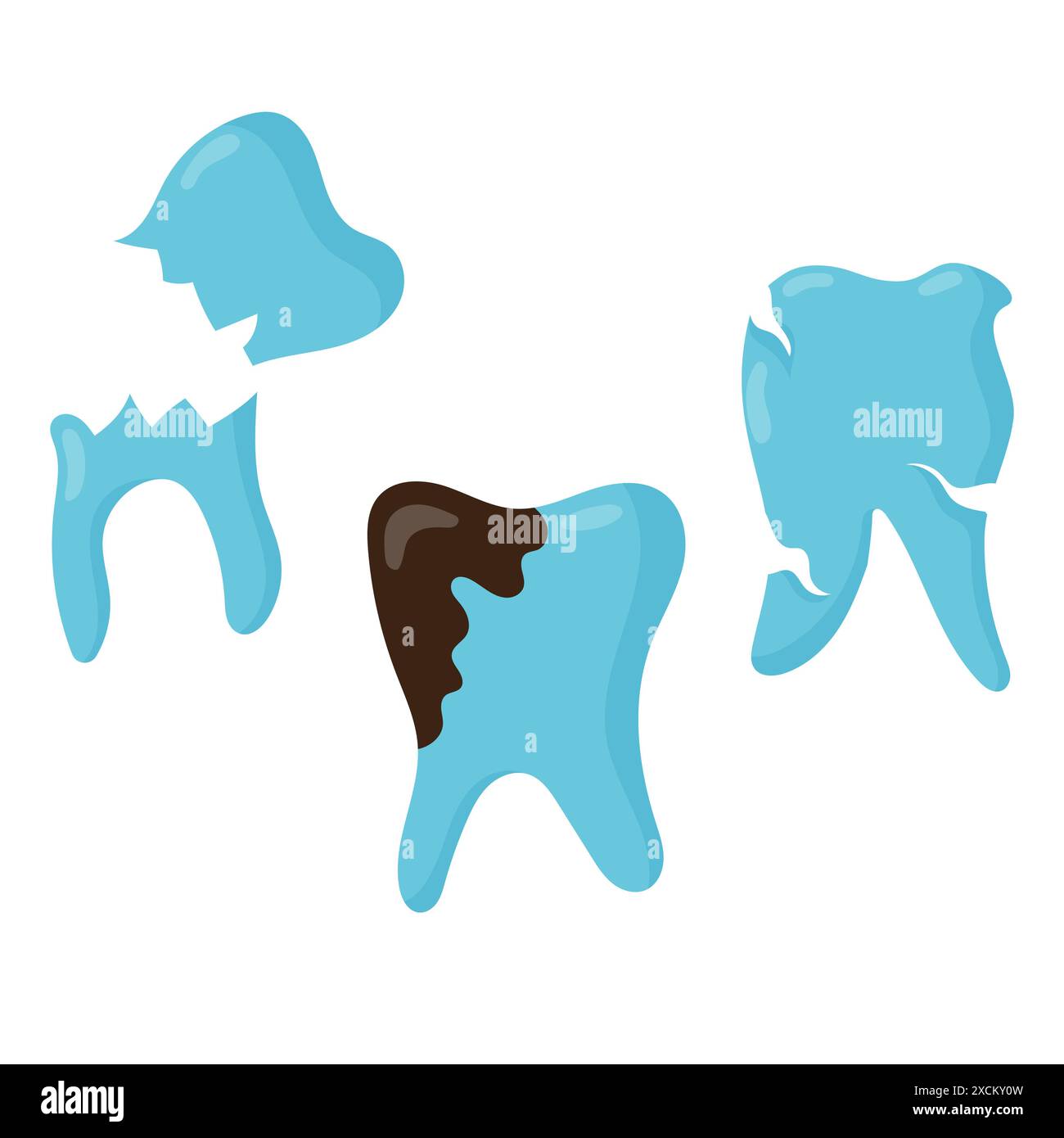 Caries. Set of carious teeth in flat style. Vector illustration ...