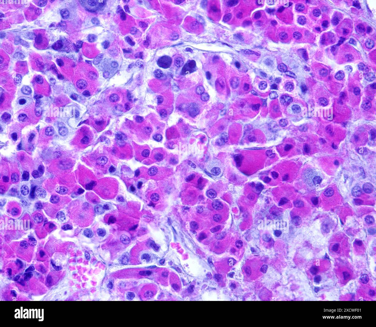 Light micrograph of an anterior human pituitary gland stained with ...