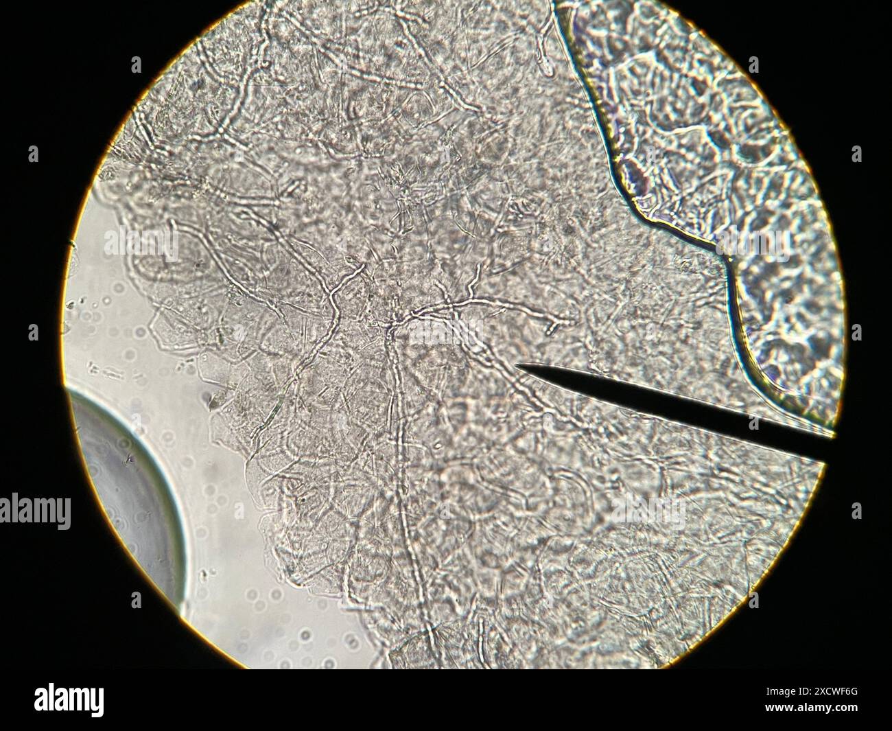Light micrograph of fungal hyphae (threads) in a sample taken from a ...