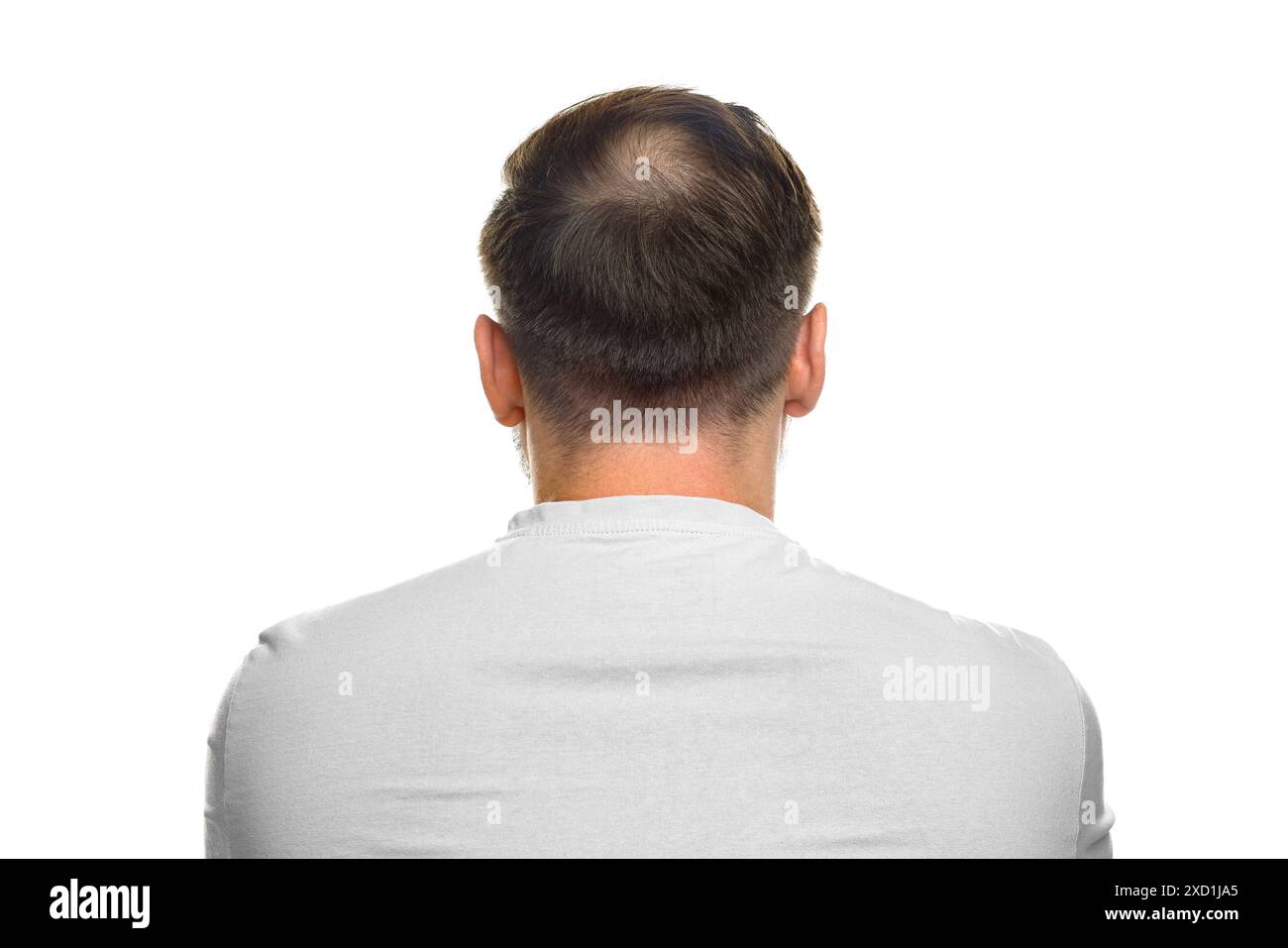 Baldness concept. Man with bald spot on white background, back view Stock Photo