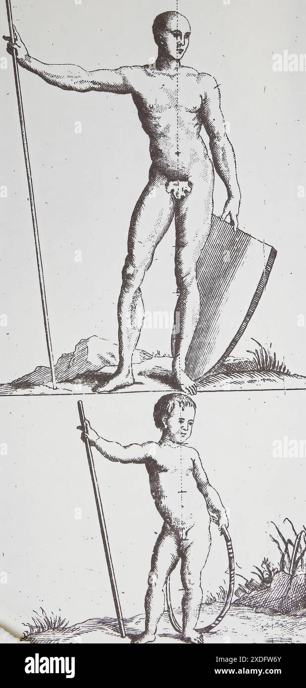 Original Illustration from Nicolas Andry book Orthopedics  from 17th century about correct body posture Stock Photo