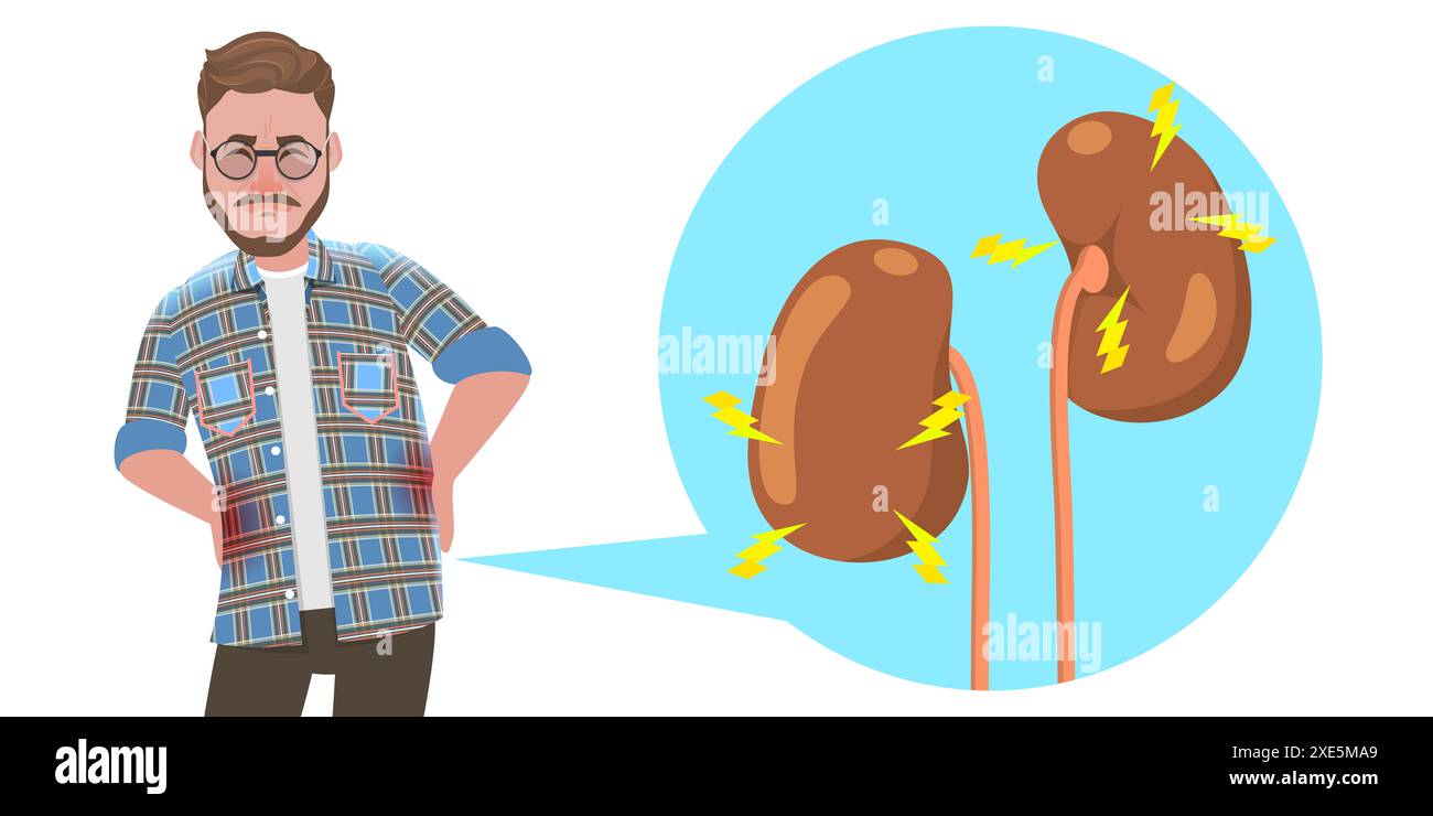 Chronic renal failure illustration Cut Out Stock Images \u0026 Pictures - Alamy, image size:1300x740