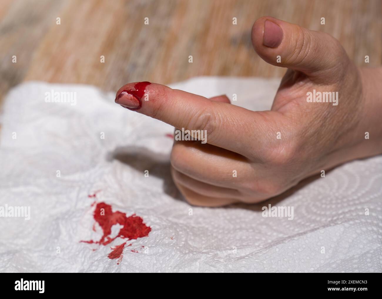 A woman's hand with a cut finger, bleeding heavily. Stock Photo