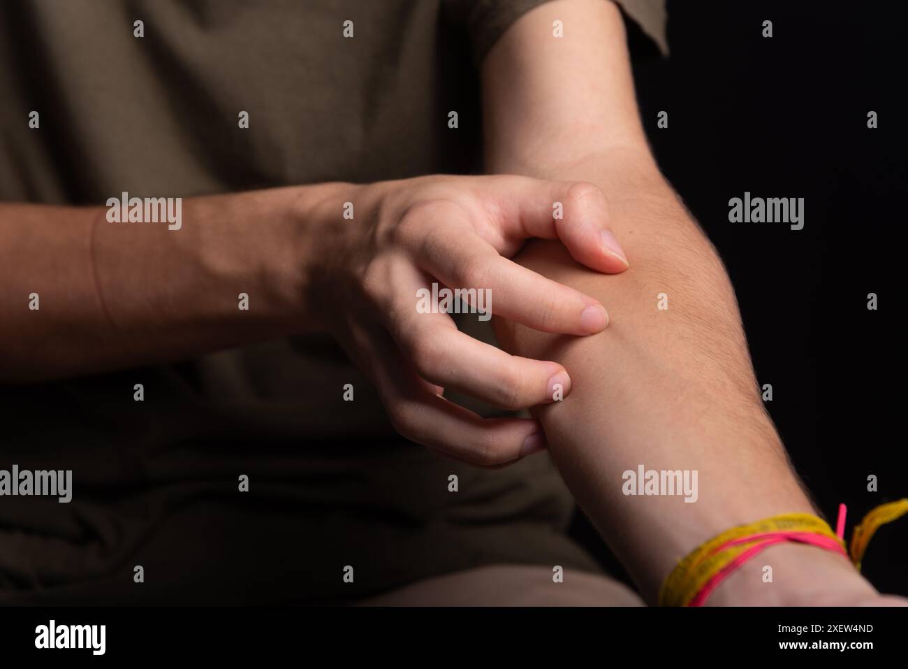 A man's hand scratching his forearm with his hand. Skin disease ...
