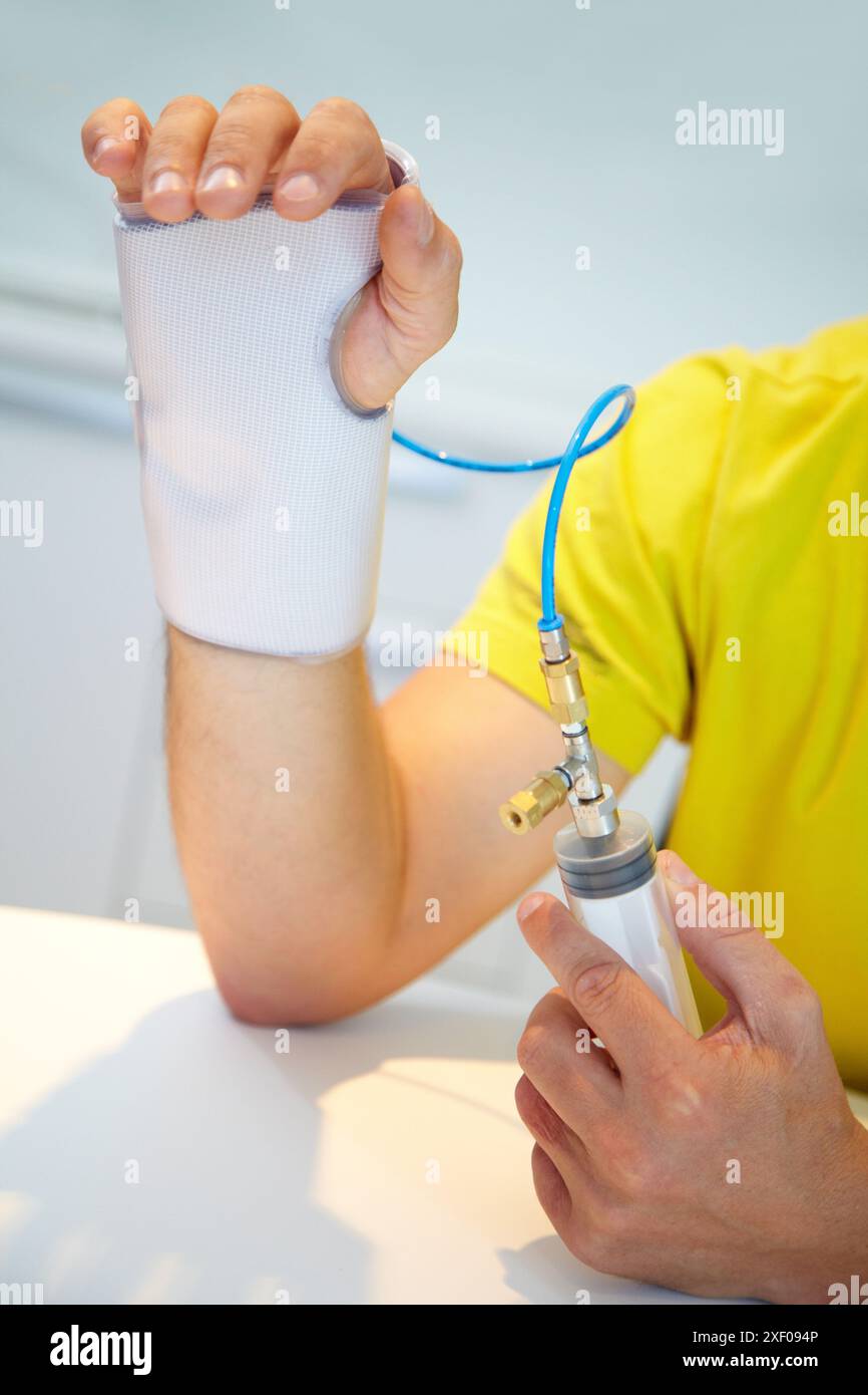 Splint Machine Splint prototype built variable stiffness textile and automatic ...