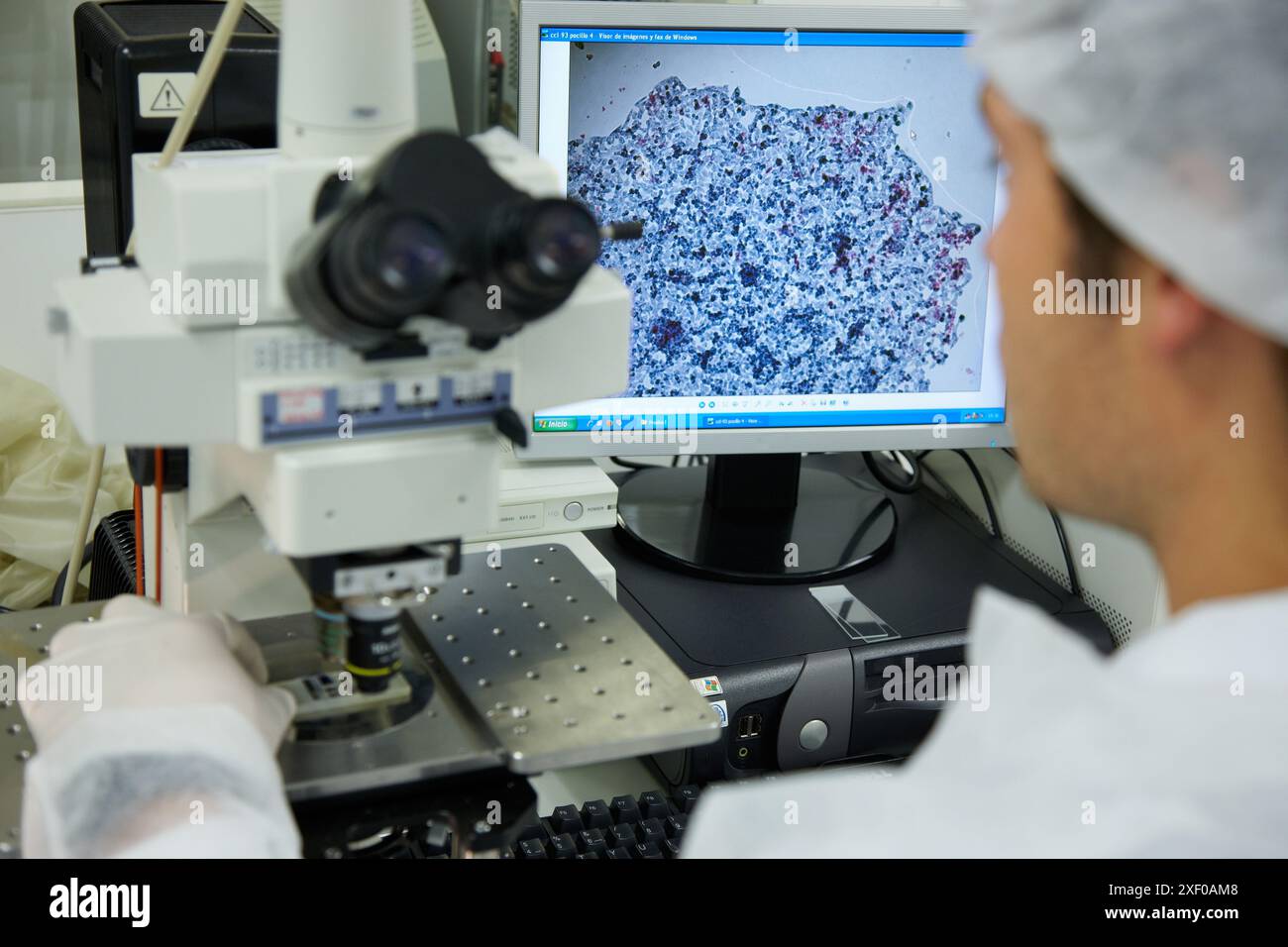 Obtention of HepG2 cell images through fluorescence microscopy in the ´colony forming assay´ to determine the toxicity of the sample, Cell Culture Lab Stock Photo