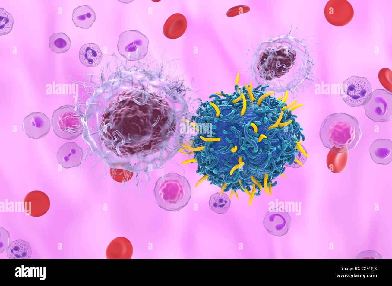 CAR T cell therapy in Hairy cell leukemia (HCL) - closeup view 3d illustration Stock Photo