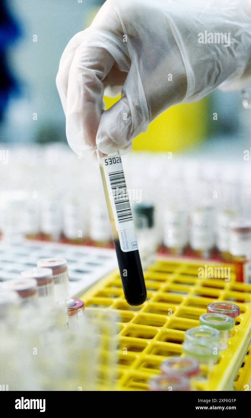 Closeup blood test in hi-res stock photography and images - Alamy