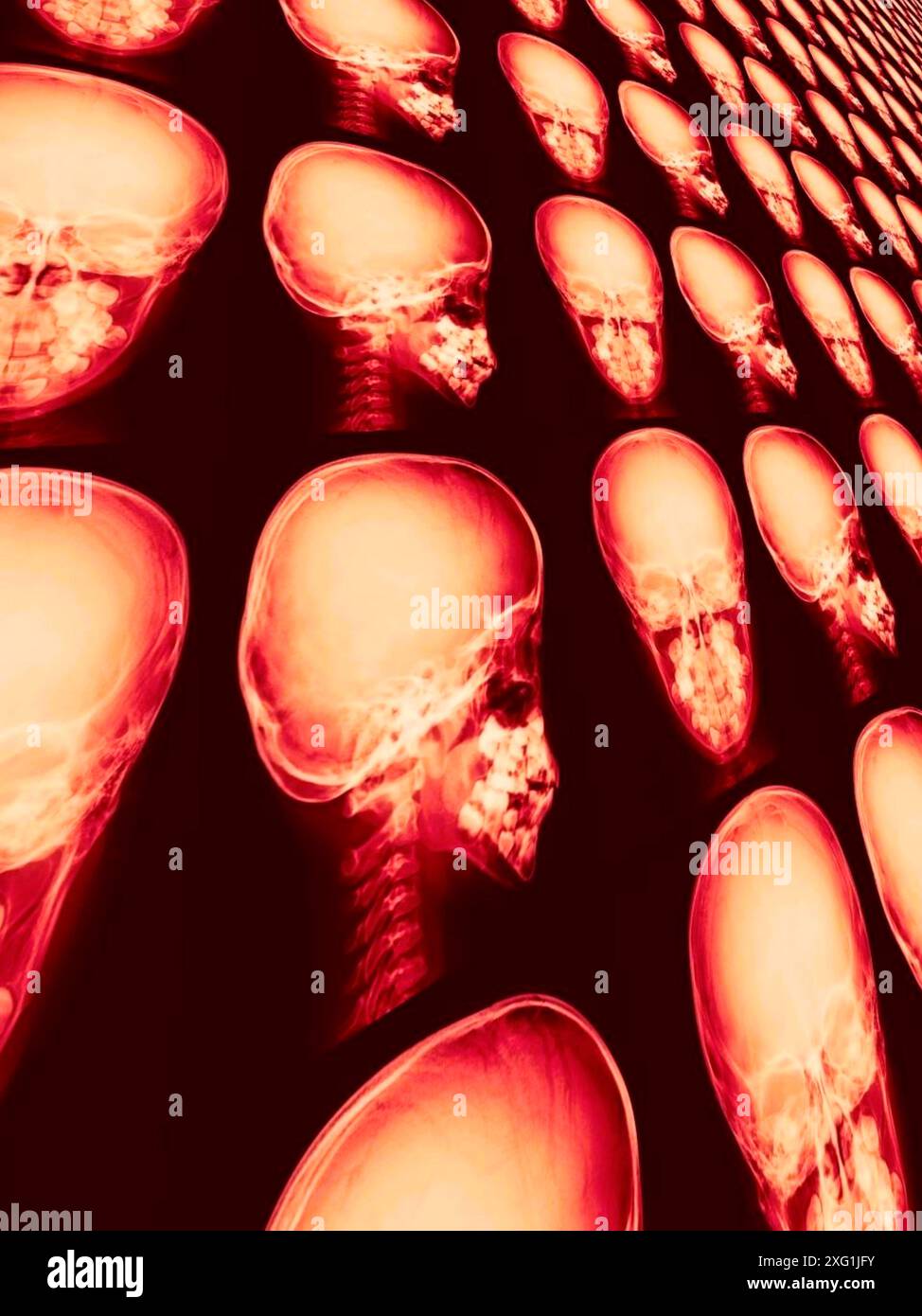Skull anterior view hi-res stock photography and images - Alamy