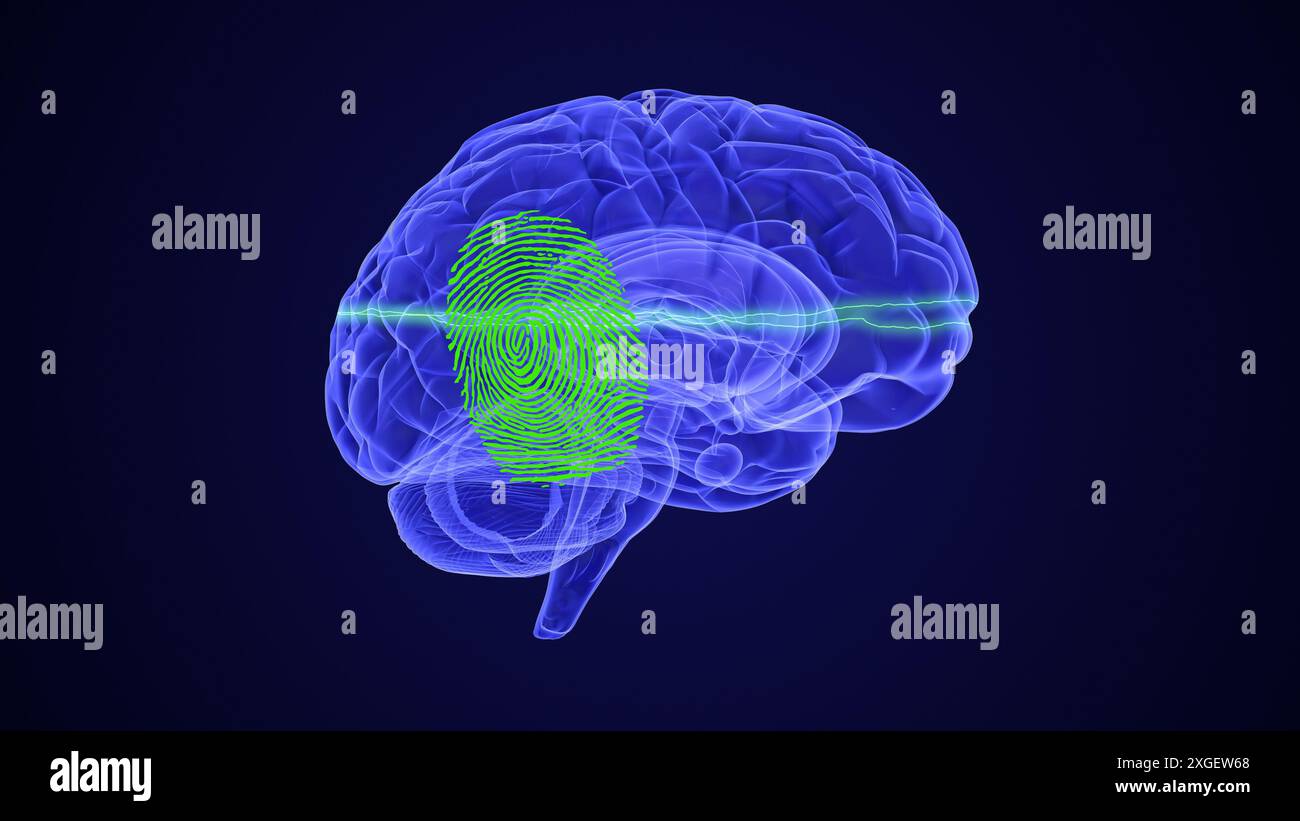 Mapping Chronic Pain in the Brain Stock Photo - Alamy