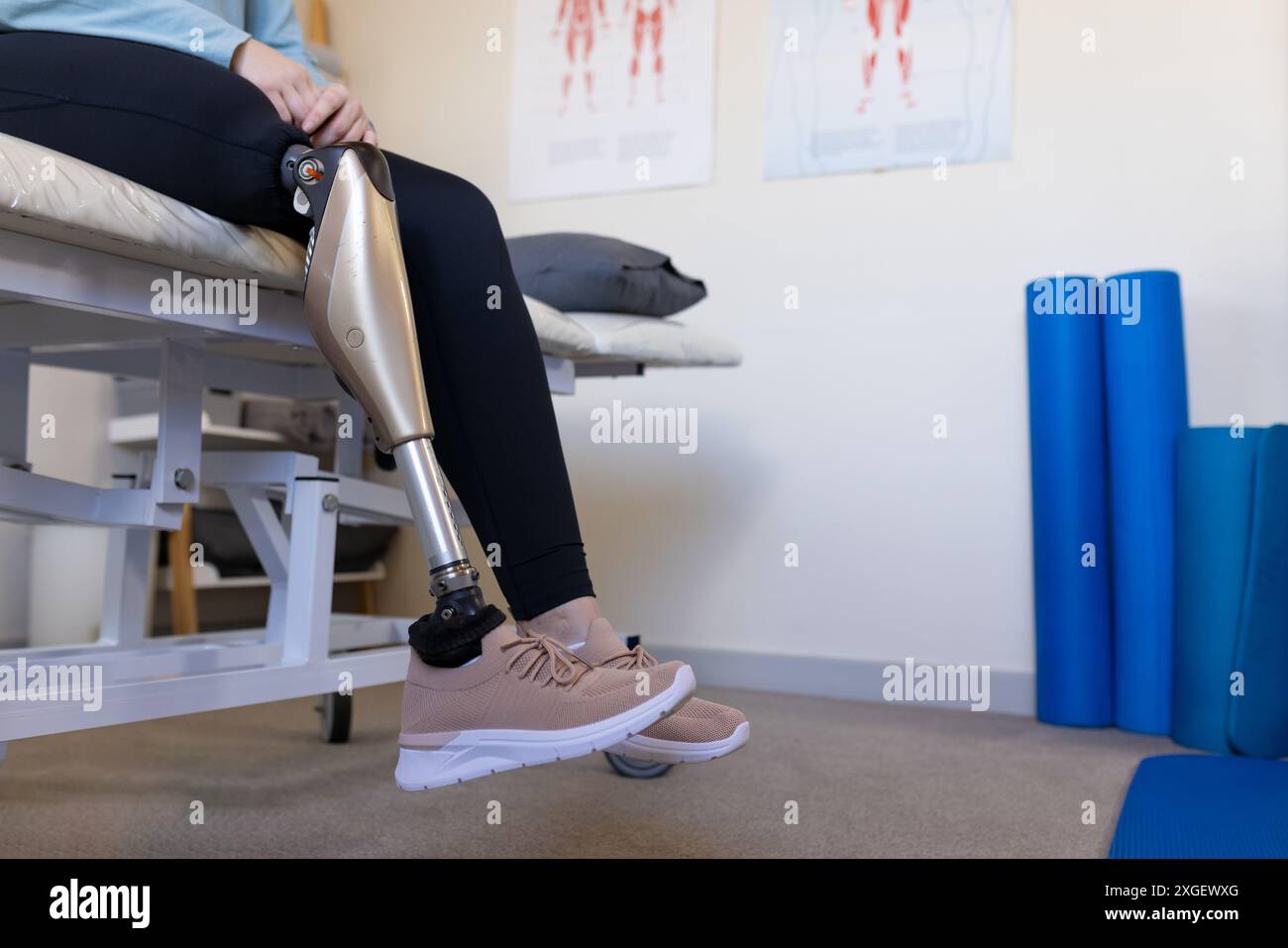 Sitting on medical bench, person with prosthetic leg in rehabilitation ...