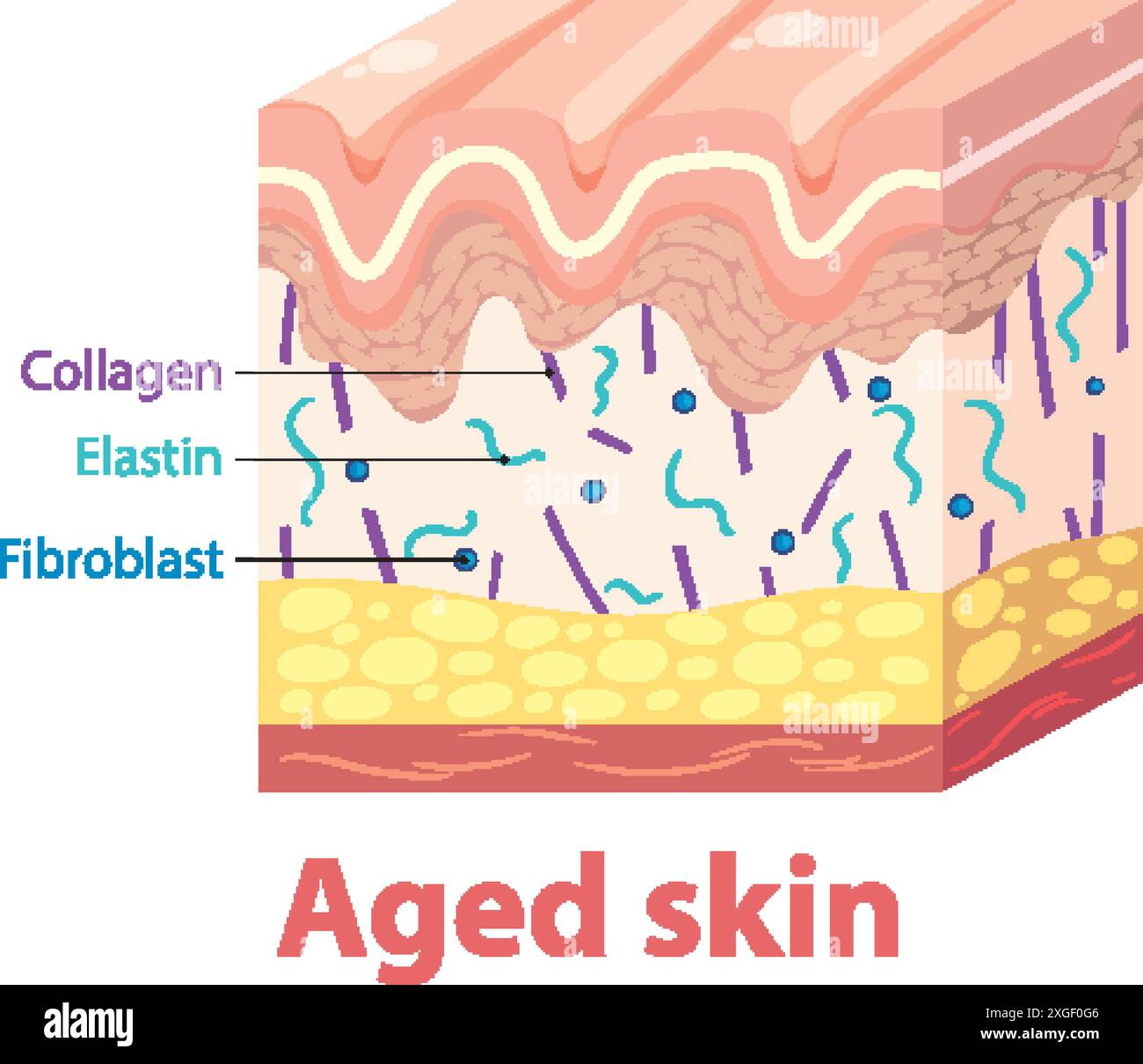 Illustration showing layers and components of aged skin Stock Vector ...