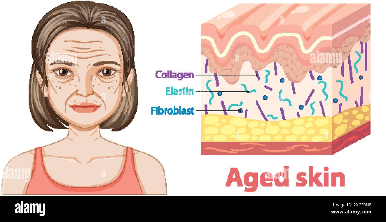 Depiction of aged skin layers and components Stock Vector Image & Art ...