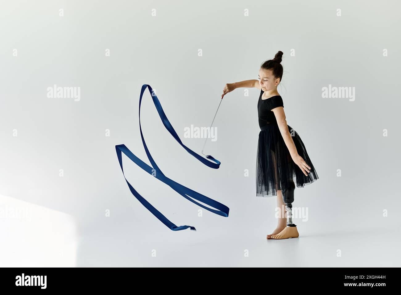 A young girl with a prosthetic leg practices rhythmic gymnastics ...
