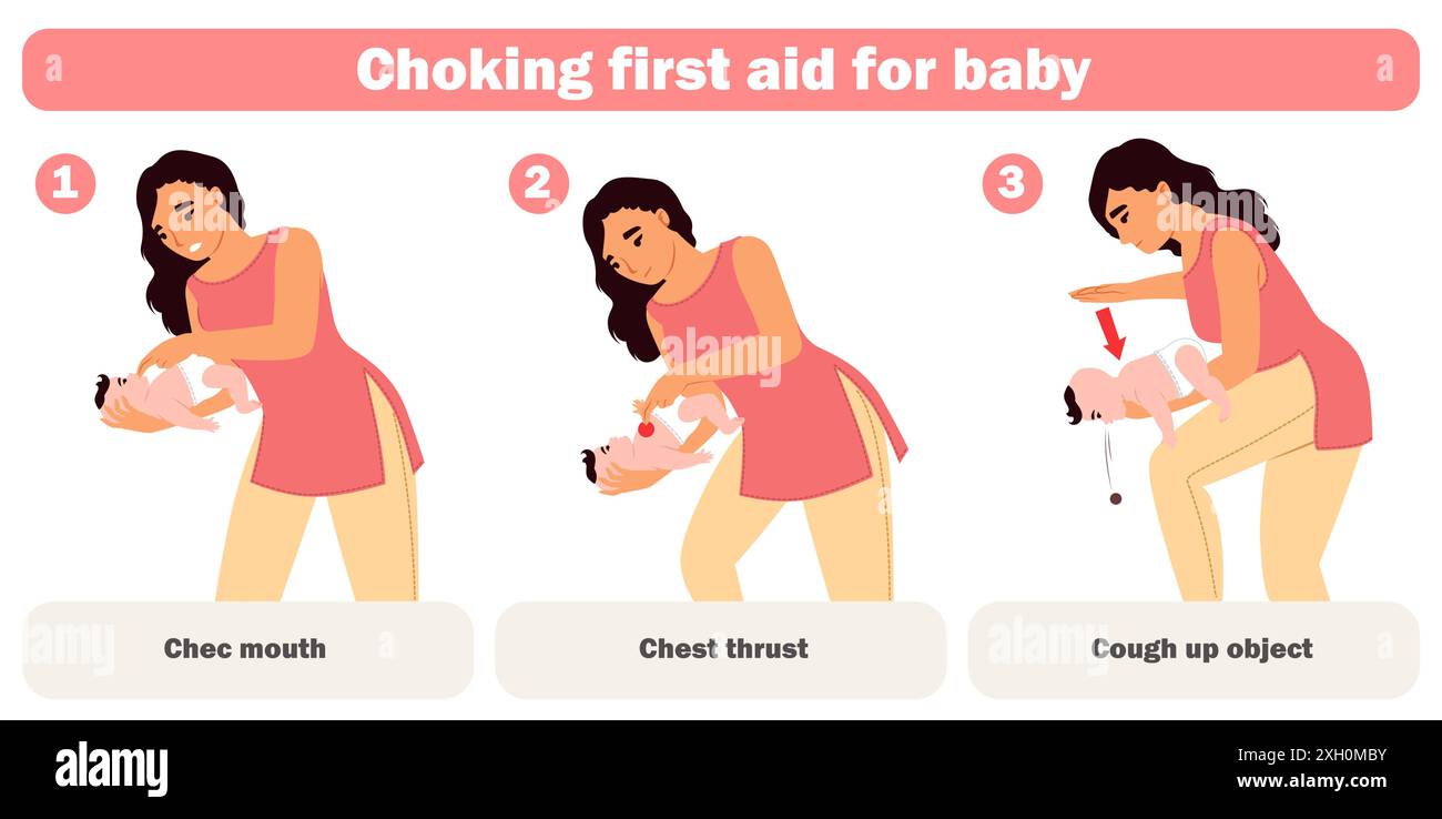 choking-first-aid-for-baby-infographic-for-mother-education-stock-vector-image-art-alamy