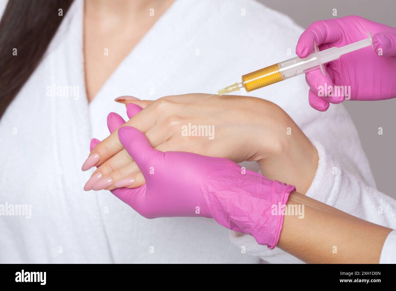 Hand Injecting Botox The doctor makes injections of botulinum toxin on the palms of a woman ...