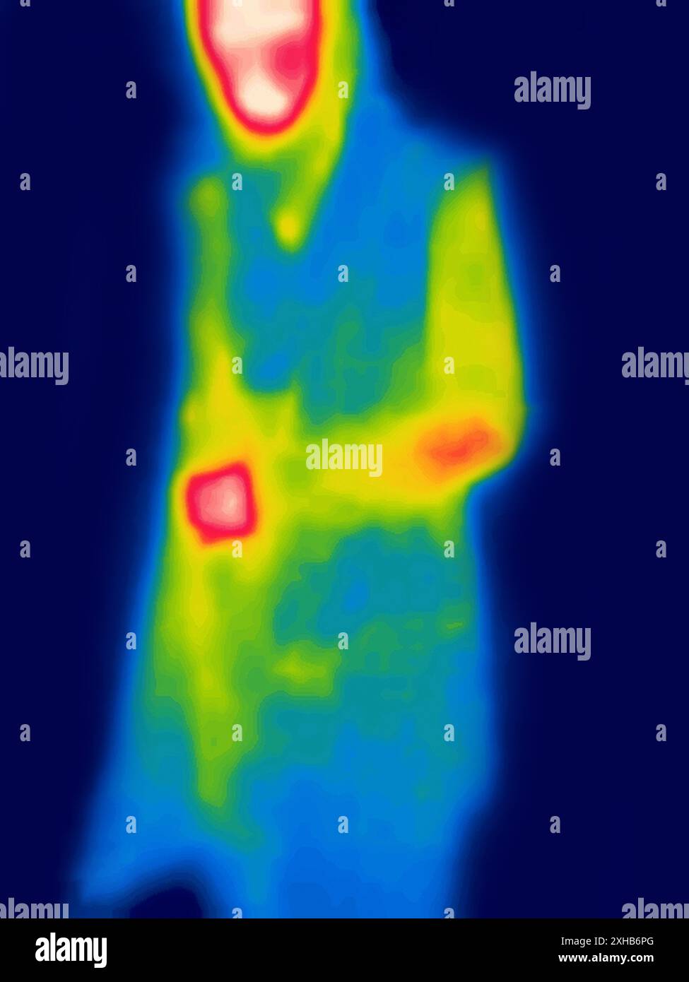 human. Image from thermal imager device Stock Photo - Alamy