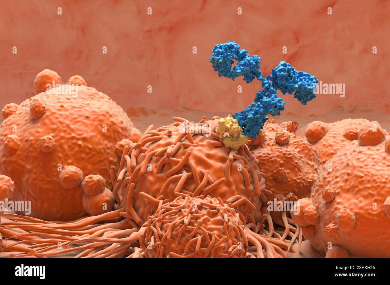 Cancer treatment carcinoma hi-res stock photography and images - Alamy